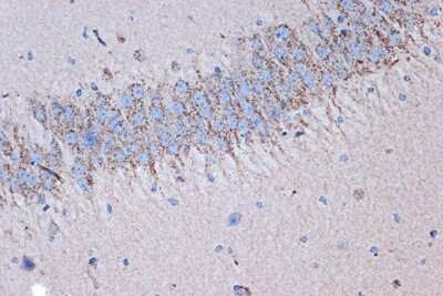 Immunohistochemistry-Paraffin: Syntenin 1 Antibody (3J5O6) [NBP3-16603]