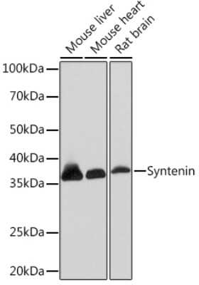 Western Blot: Syntenin 1 Antibody (3J5O6) [NBP3-16603]