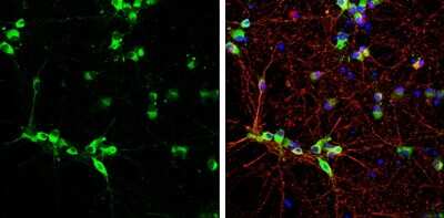 Immunocytochemistry/ Immunofluorescence: Syntenin 1 Antibody (GT1523) [NBP3-13586]
