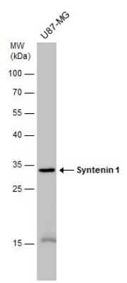 Western Blot: Syntenin 1 Antibody (GT1523) [NBP3-13586]
