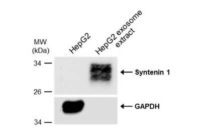 Western Blot: Syntenin 1 Antibody (GT1523) [NBP3-13586]