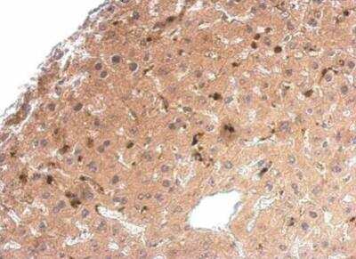 Immunohistochemistry-Paraffin: Syntenin 1 Antibody [NBP1-31136]