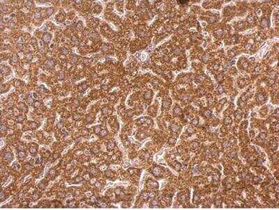 Immunohistochemistry-Paraffin: Syntenin 1 Antibody [NBP1-33661]