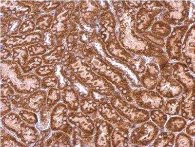 Immunohistochemistry-Paraffin: Syntenin 1 Antibody [NBP1-33661]
