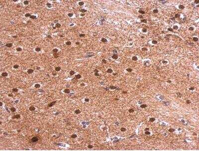 Immunohistochemistry-Paraffin: Syntenin 1 Antibody [NBP1-33661]