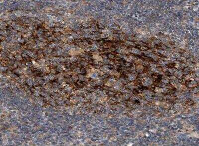 Immunohistochemistry-Paraffin: Syntenin 1 Antibody [NBP1-86979]