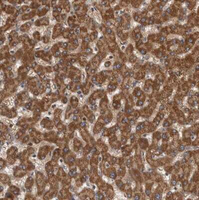 Immunohistochemistry-Paraffin: Syntenin 1 Antibody [NBP1-86979]