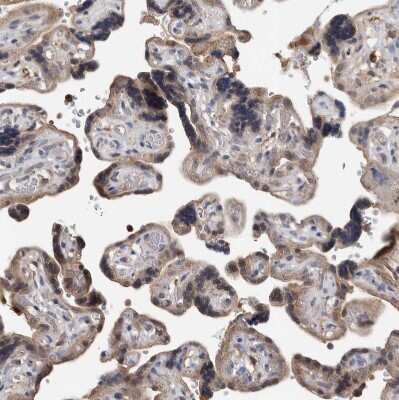 Immunohistochemistry-Paraffin: Syntenin 1 Antibody [NBP1-86979]