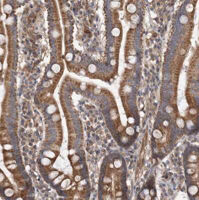 Immunohistochemistry-Paraffin: Syntenin 1 Antibody [NBP1-86979]