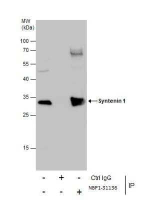 Immunoprecipitation: Syntenin 1 Antibody [NBP1-31136]