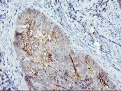 Immunohistochemistry: Syntenin 1 Antibody (OTI2H6) - Azide and BSA Free [NBP2-74418]