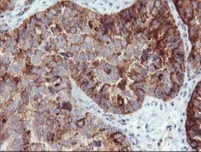 Immunohistochemistry: Syntenin 1 Antibody (OTI2H6) - Azide and BSA Free [NBP2-74418]