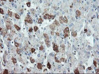 Immunohistochemistry: Syntenin 1 Antibody (OTI2H6) - Azide and BSA Free [NBP2-74418]