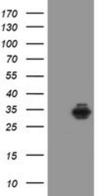 Western Blot: Syntenin 1 Antibody (OTI2H6)Azide and BSA Free [NBP2-74418]