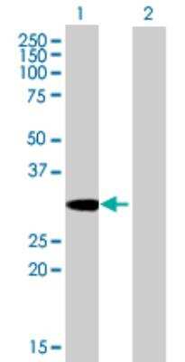 Western Blot: Syntenin 1 Antibody [H00006386-B01P]