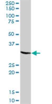 Western Blot: Syntenin 1 Antibody [H00006386-B01P]