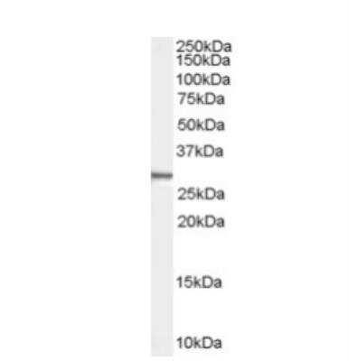 Western Blot: Syntenin 1 Antibody [NB100-53807]