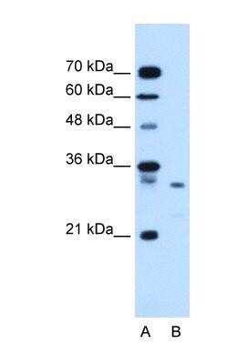 Western Blot: Syntenin 1 Antibody [NBP1-59336]