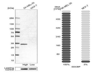 Western Blot: Syntenin 1 Antibody [NBP1-86979]