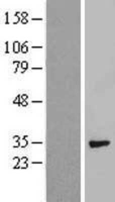 Western Blot: Syntenin 1 Overexpression Lysate [NBP2-10454]