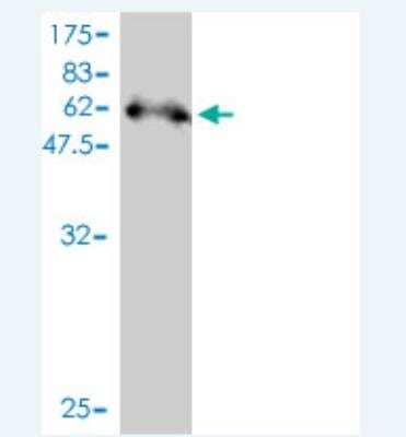 Western Blot: Syntenin 2 Antibody (3E8) [H00027111-M01]