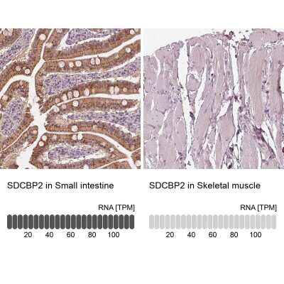 Immunohistochemistry-Paraffin: Syntenin 2 Antibody [NBP2-62642]