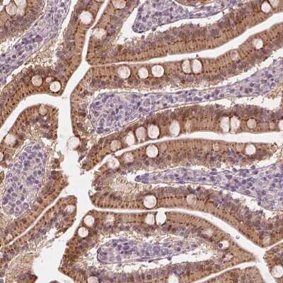 Immunohistochemistry-Paraffin: Syntenin 2 Antibody [NBP2-62642]