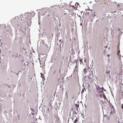 Immunohistochemistry-Paraffin: Syntenin 2 Antibody [NBP2-62642]