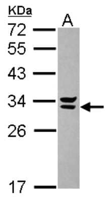 Western Blot: Syntenin 2 Antibody [NBP2-20550]