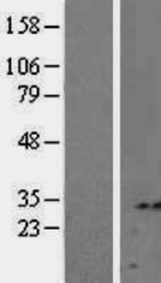 Western Blot: Syntenin 2 Overexpression Lysate [NBL1-15762]