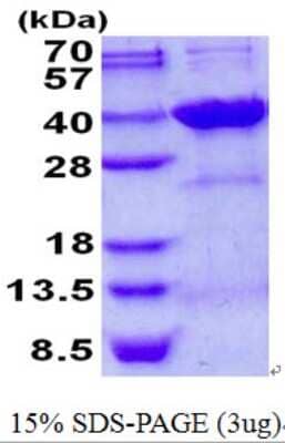 SDS-PAGE: Recombinant Human Syntenin 2 His Protein [NBP2-22840]