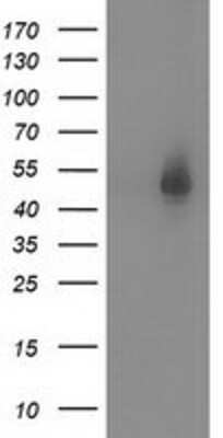 Western Blot: Syntrophin alpha 1 Antibody (OTI1H10) [NBP2-03302]