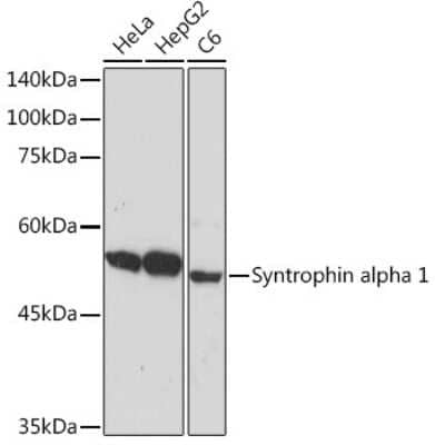 Western Blot: Syntrophin alpha 1 Antibody (3B10G10) [NBP3-15899]