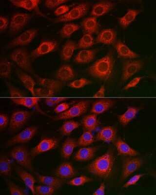 Immunocytochemistry/ Immunofluorescence: Syntrophin alpha 1 Antibody - Azide and BSA Free [NBP3-16017]