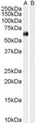 Western Blot: Syntrophin alpha 1 Antibody [NB100-1346]
