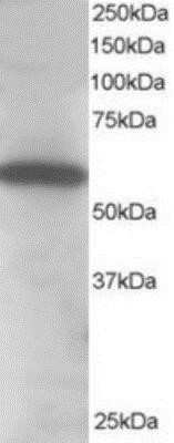 Western Blot: Syntrophin alpha 1 Antibody [NB100-1346]