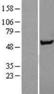 Western Blot: Syntrophin alpha 1 Overexpression Lysate [NBL1-16297]