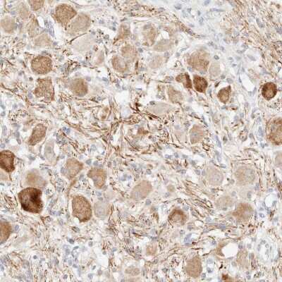 Immunohistochemistry-Paraffin: Syntrophin beta 1 Antibody [NBP1-90323]