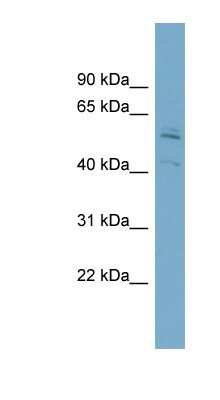 Western Blot: Syntrophin beta 1 Antibody [NBP1-59784]
