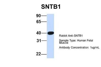 Western Blot: Syntrophin beta 1 Antibody [NBP1-59784]