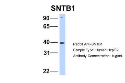 Western Blot: Syntrophin beta 1 Antibody [NBP1-59784]
