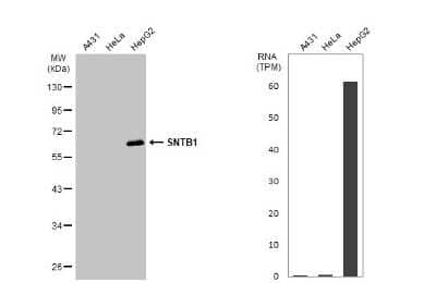 Western Blot: Syntrophin beta 1 Antibody [NBP3-13150]