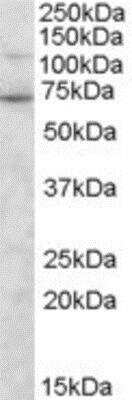 Western Blot: Syntrophin gamma 2 Antibody [NB100-1392]