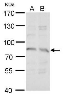 Western Blot: Syntrophin gamma 2 Antibody [NBP2-43799]