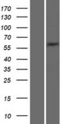 Western Blot: Syntrophin gamma 2 Overexpression Lysate [NBP2-06752]