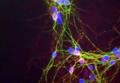 Immunocytochemistry/ Immunofluorescence: alpha-Synuclein Antibody (2A7) [NBP1-05194]