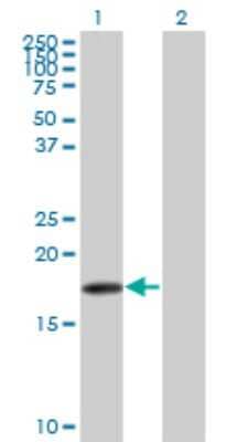 Western Blot: beta-Synuclein Antibody (3H4) [H00006620-M07]