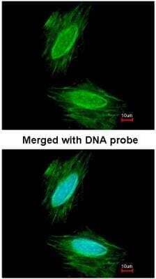 Immunocytochemistry/ Immunofluorescence: gamma-Synuclein Antibody [NBP1-31209]