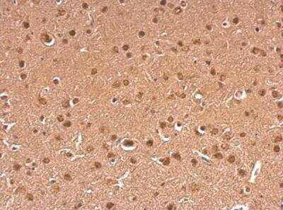 Immunohistochemistry-Paraffin: gamma-Synuclein Antibody [NBP1-31209]
