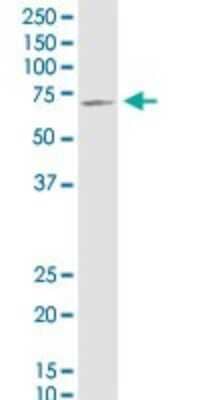 Western Blot: T Plastin Antibody (5B9) [H00005358-M01]